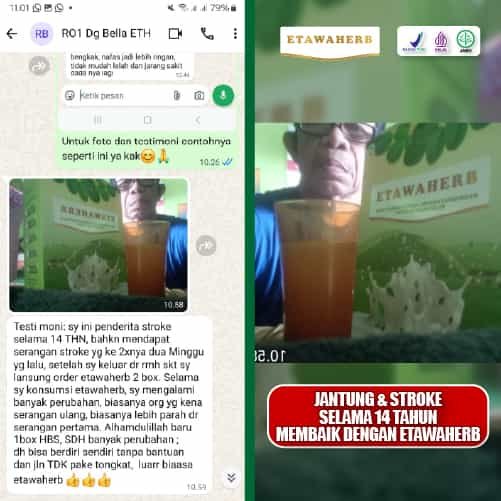 Testimoni Jantung stroke 2